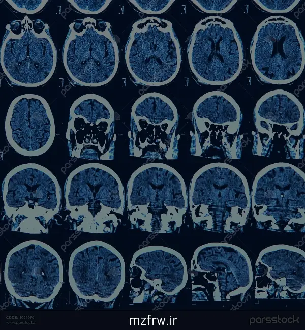 درباره عملکرد مغز خود چه می دانیم